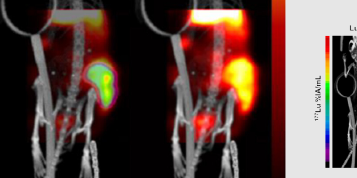 Quantitative SPECT imaging of theranostics: radionuclide imaging and quantification for therapy and in vivo biodosimetry