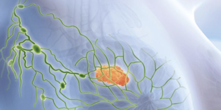 Superior AI-boosted 3D breast ultrasound imaging